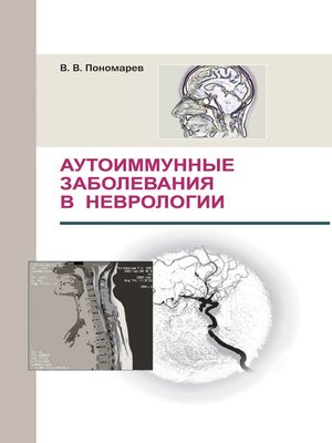 cover image of Аутоиммунные заболевания в неврологии